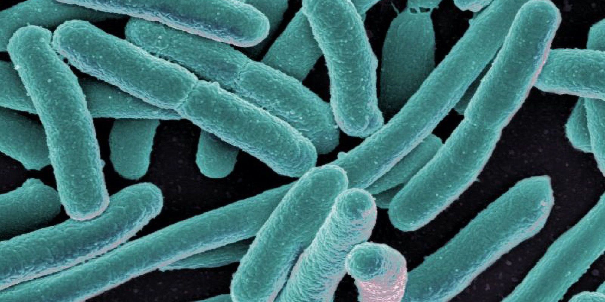 Legionella Metodi Di Bonifica E Sistemi Di Prevenzione Technoacque Srl
